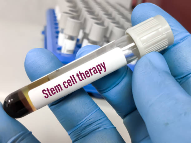 At-Home Stem Cell Therapy